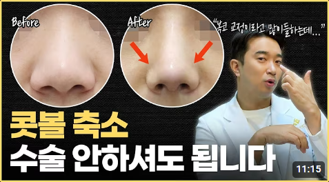 노션 레퍼런스 #125