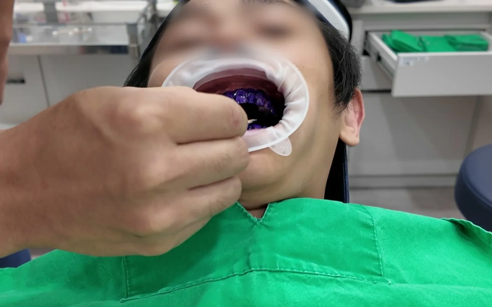 비싼 전동칫솔로 양치해도 잇몸병 생기는 이유