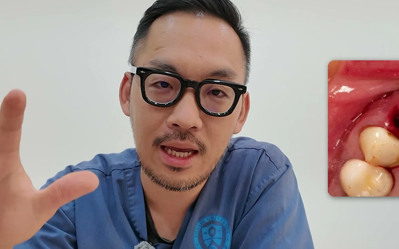 치과에서 가장 아픈 치료, 사랑니 발치 아닌 신경치료