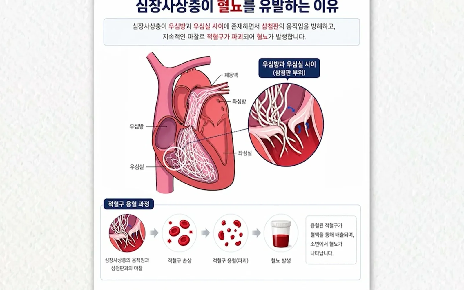 기침 없는 강아지 심장, 30cm 기생충이 자라고 있다