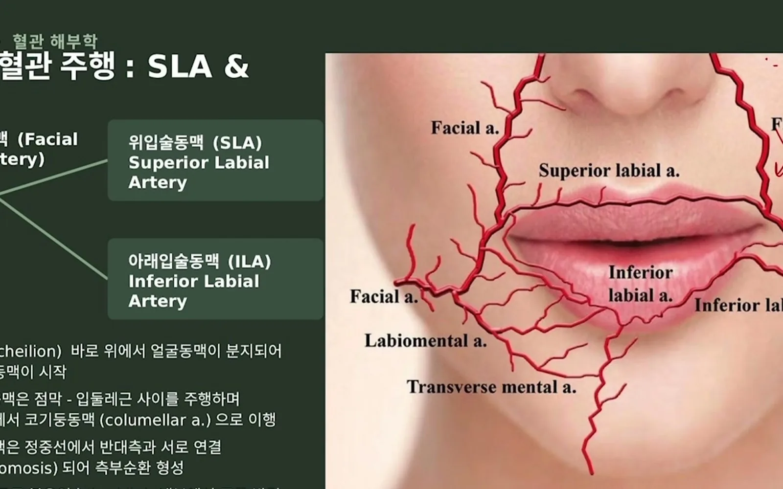 입술 필러 후 생긴 콧수염 자국, 원인은 주입 위치다