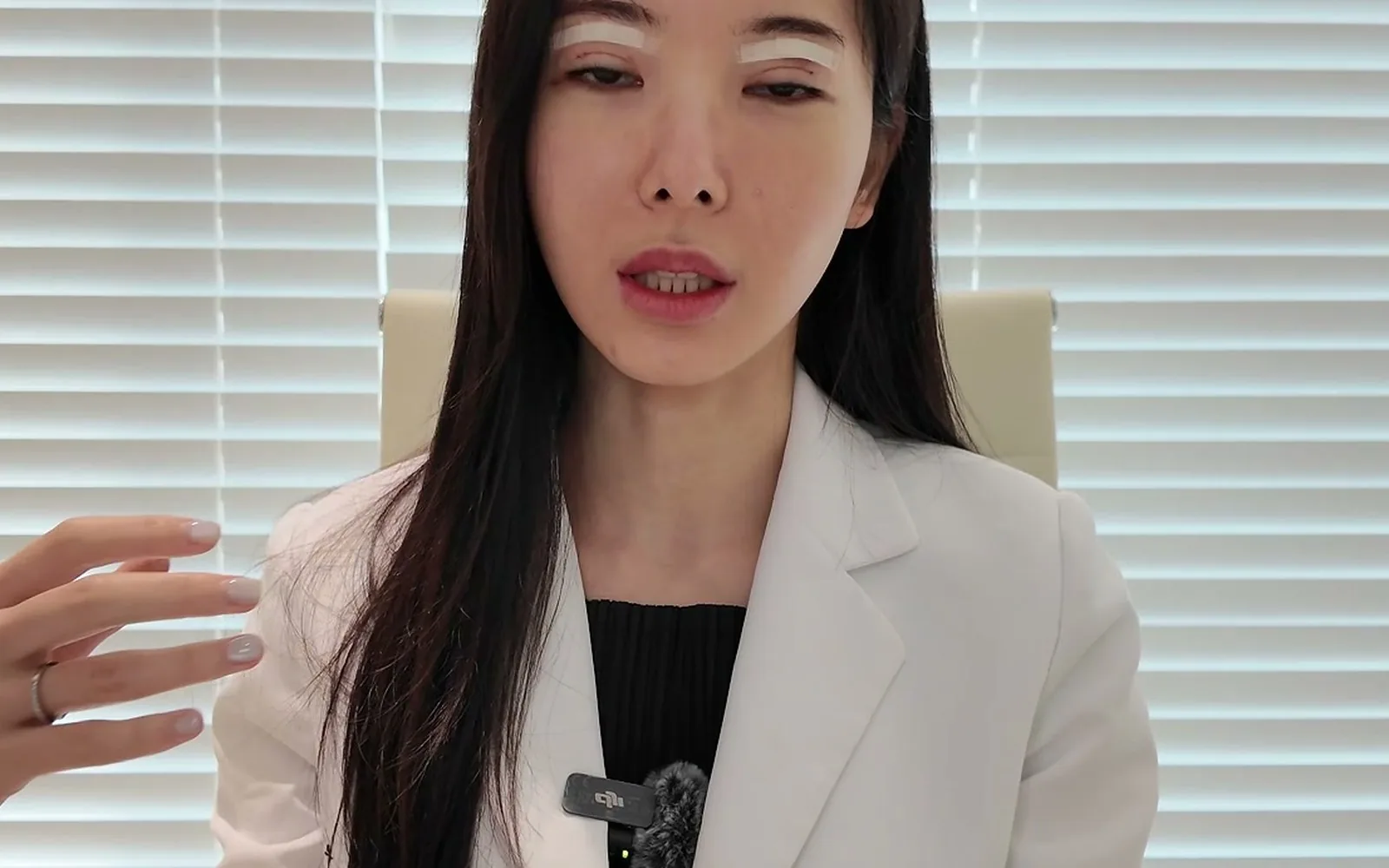 쌍꺼풀 수술 직후 호박즙 먹어도 부기 안 빠지는 이유