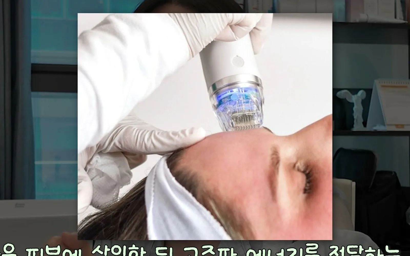 여드름 짜고 남은 붉은 자국, 흉터 연고 발라도 소용없는 이유
