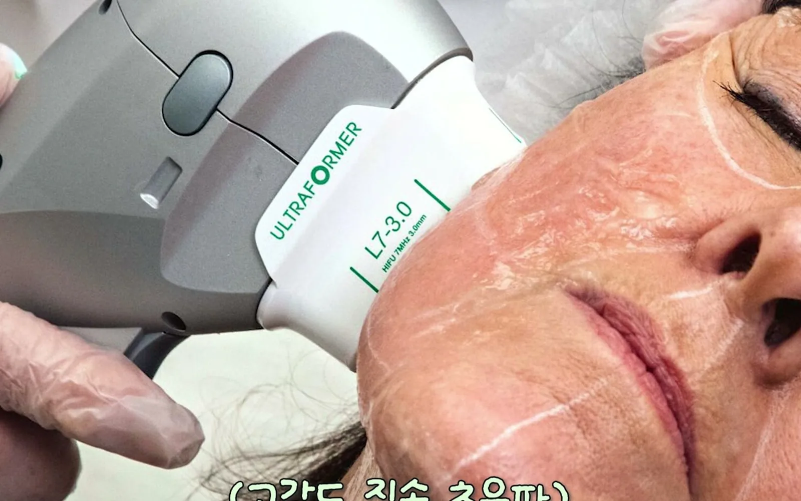 이마 필러 맞은 뒤 뿔처럼 튀어나오는 원인