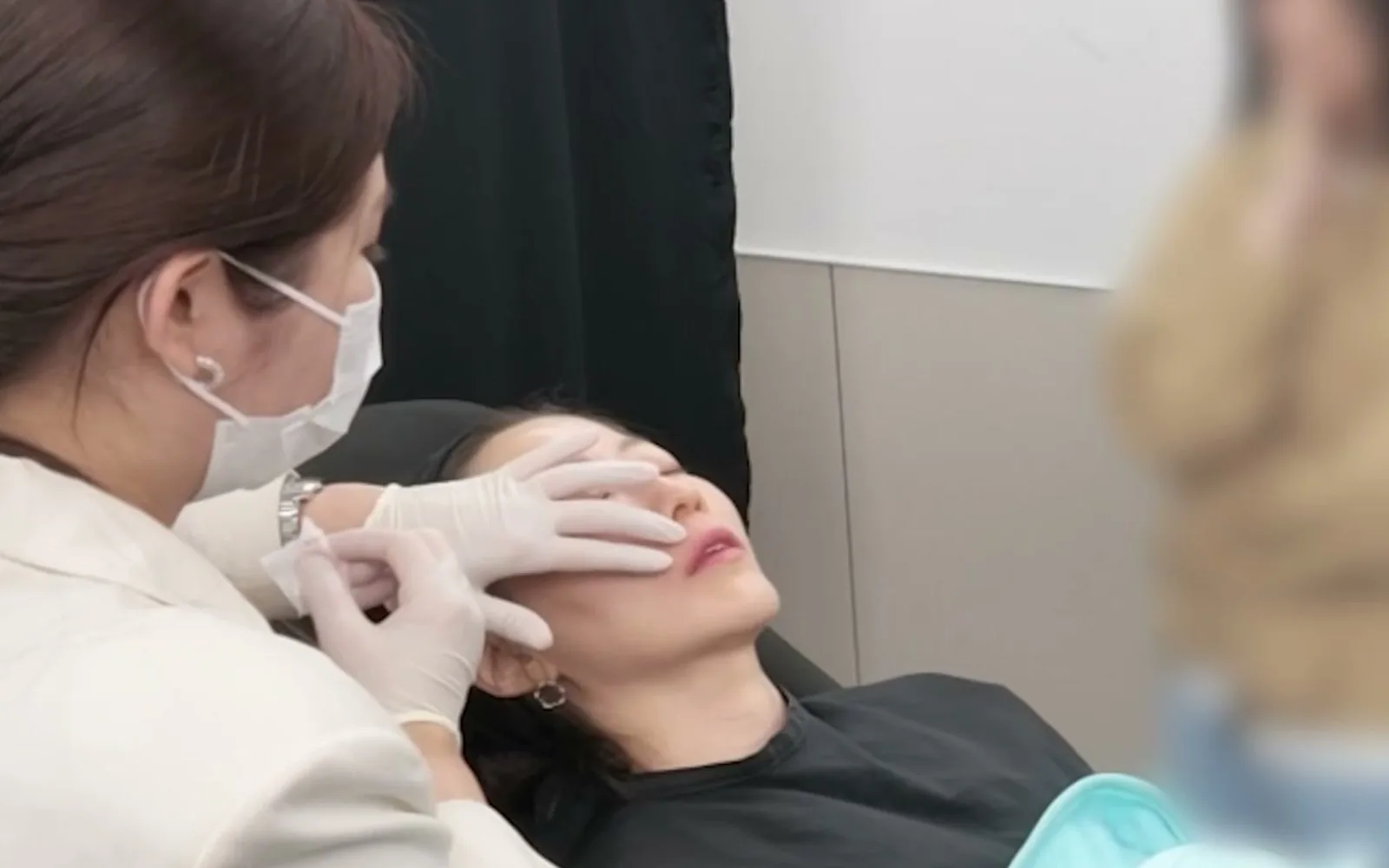 입술 필러 한 번에 끝내면 안 되는 이유