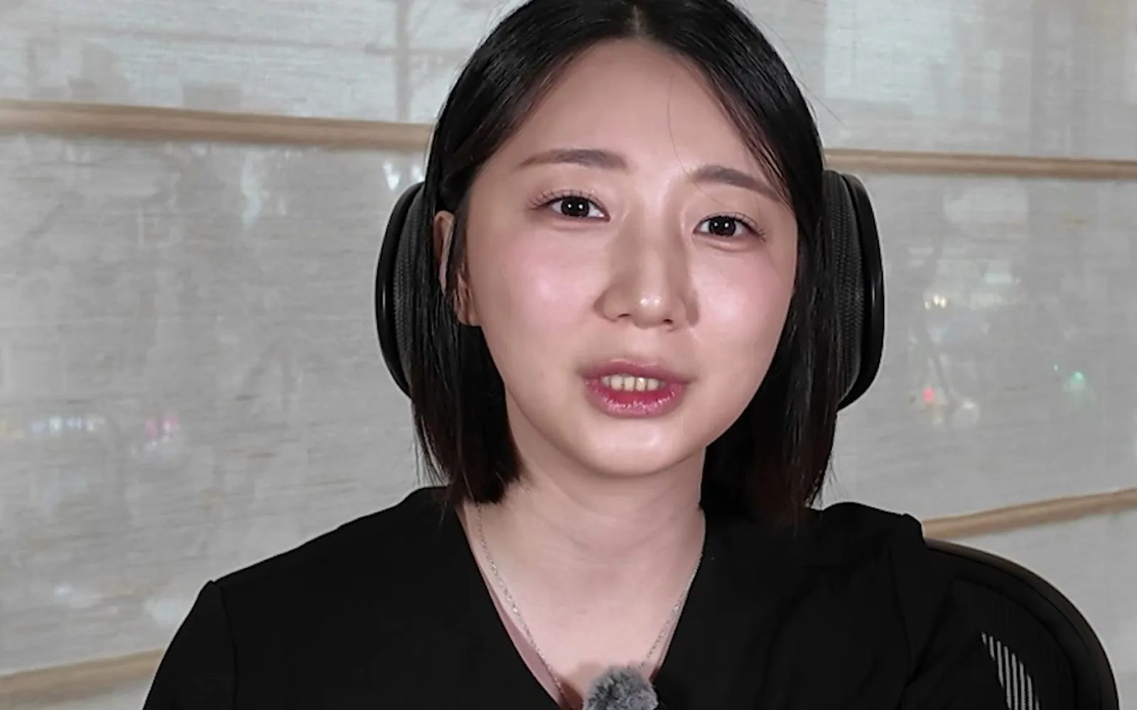 찌푸릴 때 깊게 패는 주름, 기기 시술로 안 펴지는 이유