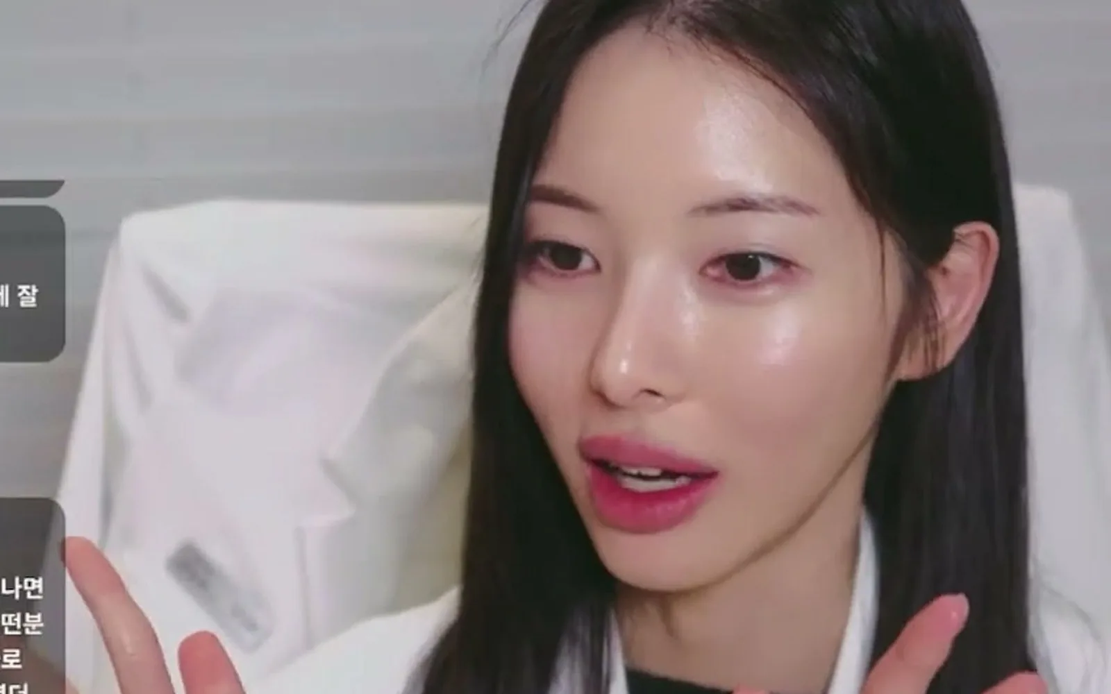 필러는 시간 지나면 다 녹는다? 반은 틀렸다