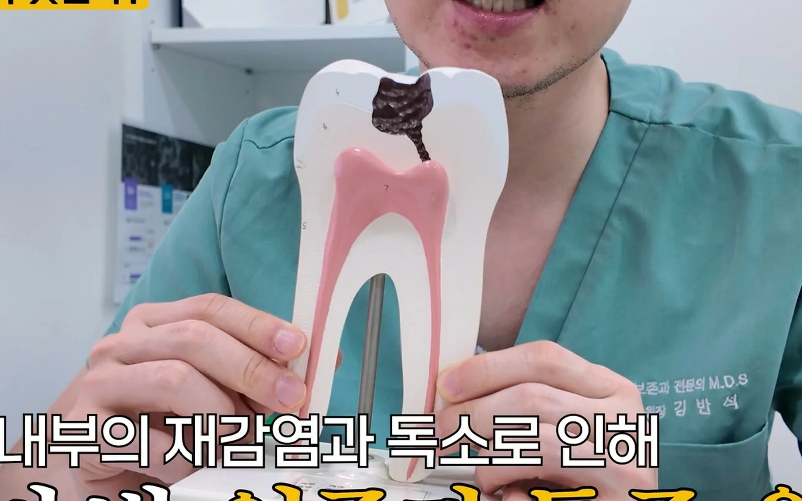 신경치료 10년 후 생긴 통증, 발치 전 확인해야 할 3가지