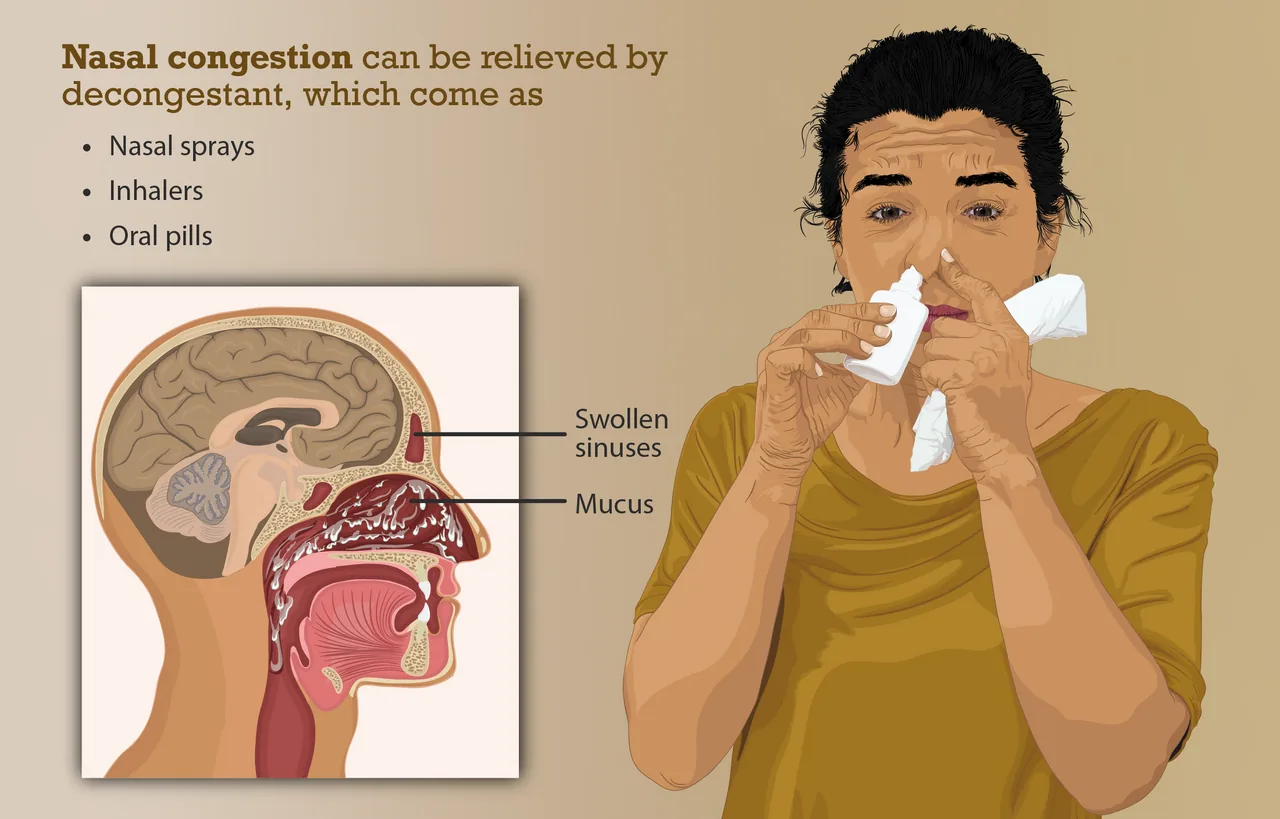 Depiction of a person suffering from Nasal Congestion